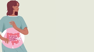 Who's Getting Colon Cancer?