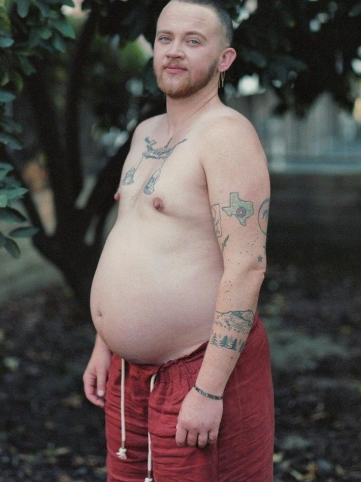 সন্তানের জন্ম দিয়ে আজব দাবি রূপান্তরকামী পুরুষের