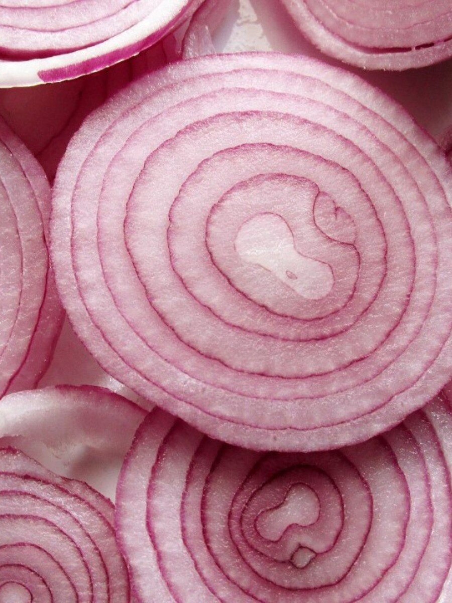 খুব বেশি পেঁয়াজ খান? ফল হতে পারে মারাত্মক!