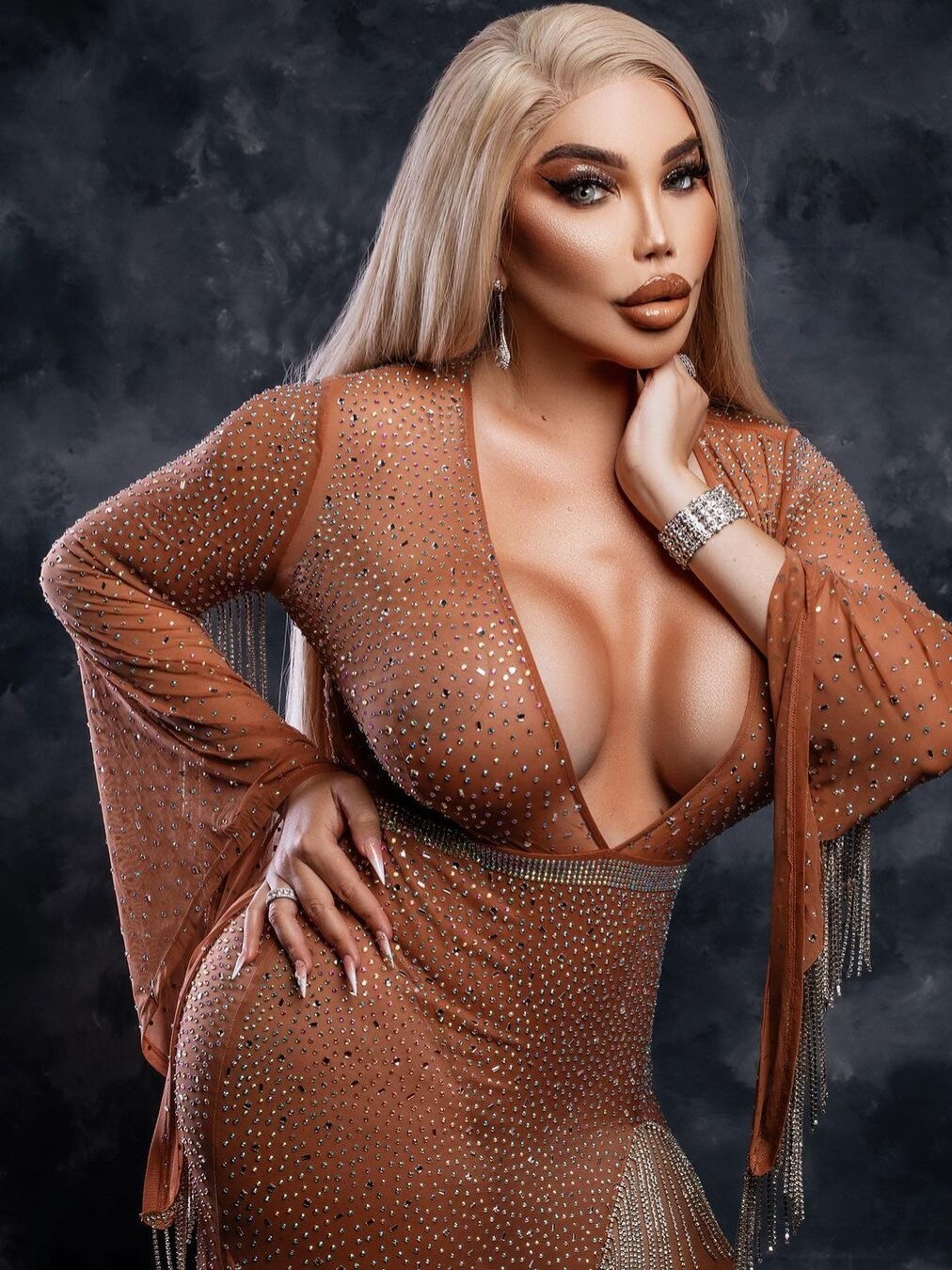 लड़का से लड़की बना ये स्टार, कराईं 90 सर्जरी