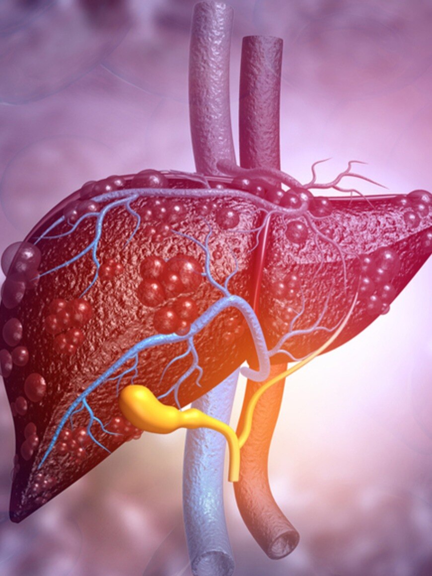 লিভার নষ্টের কারণ হতে পারে এই ৮ জিনিস