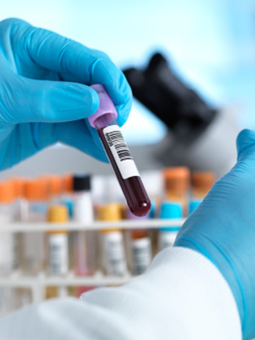  কোন  ব্লাড গ্রুপের লোকেদের অল্প বয়সে স্ট্রোকের ঝুঁকি বেশি?