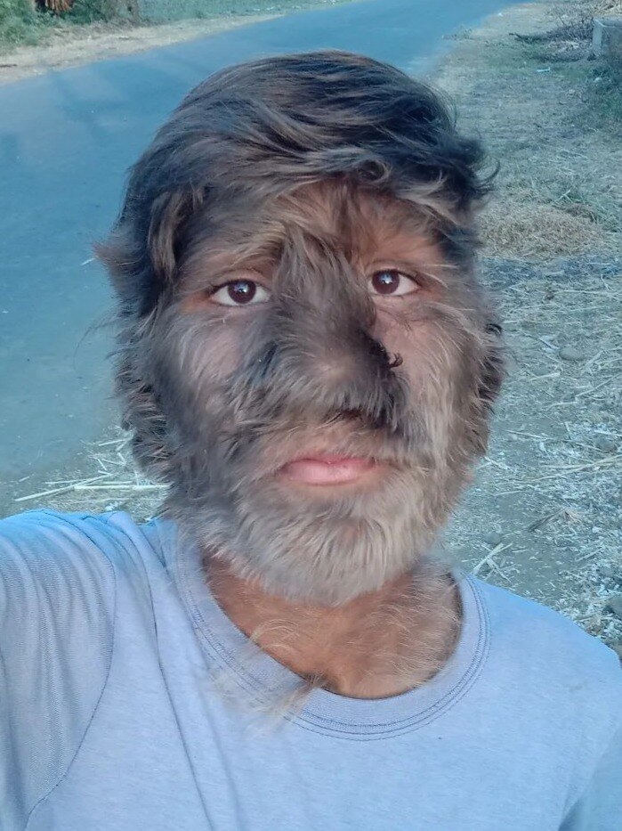 'बाल हनुमान' क्यों कहलाते हैं ललित पाटीदार?