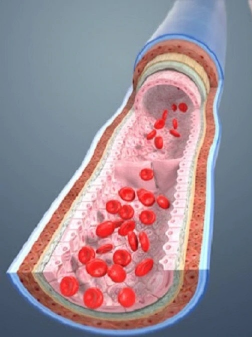  ইউরিক অ্যাসিড থেকে বাঁচতে দূরে রাখুন ৫ খাবার