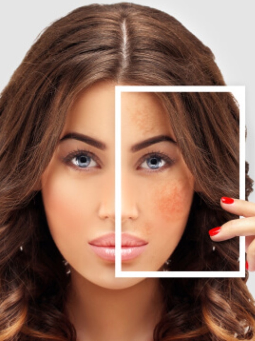 Pigmentation Skin Care Tips sus