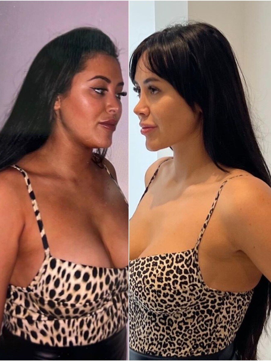 डिलीवरी के बाद घटाया वजन, शॉक हुए फैन्स बोले- सब एडटिंंग है