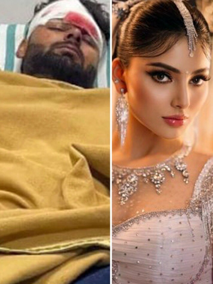 अस्पताल में ऋषभ पंत, दुबई में चिल कर रहीं उर्वशी, यूजर्स बोले- भैया की टेंशन नहीं ?