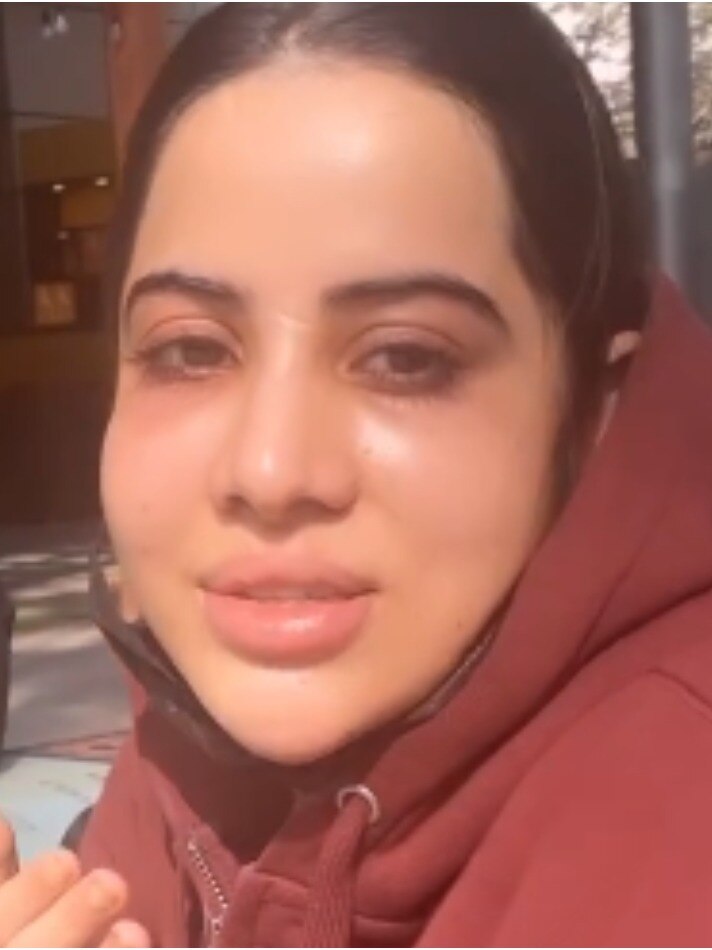 सूजी आंखें, बिगड़ा चेहरा, उर्फी ने क्या कर लिया? पहचान पाना हुआ मुश्किल