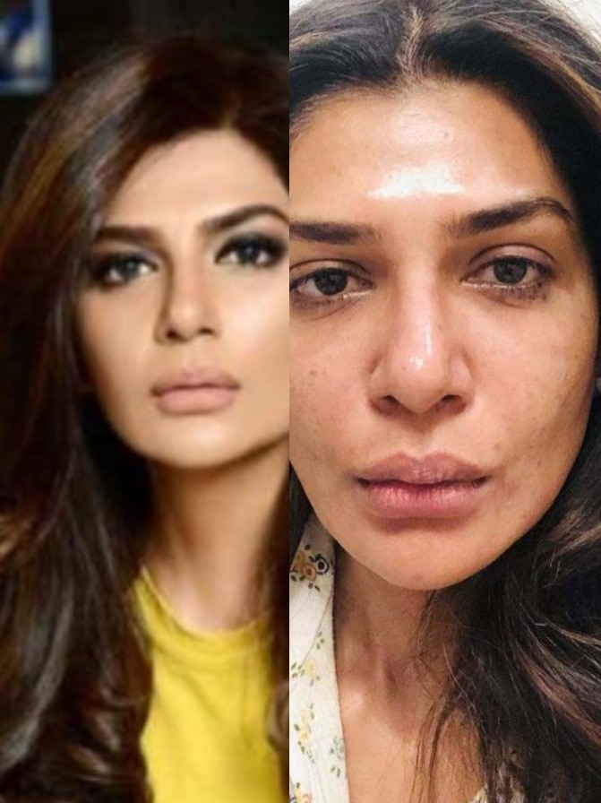 PAK एक्ट्रेस को जवां दिखने की चाहत, 61 की उम्र में कराई सर्जरी
