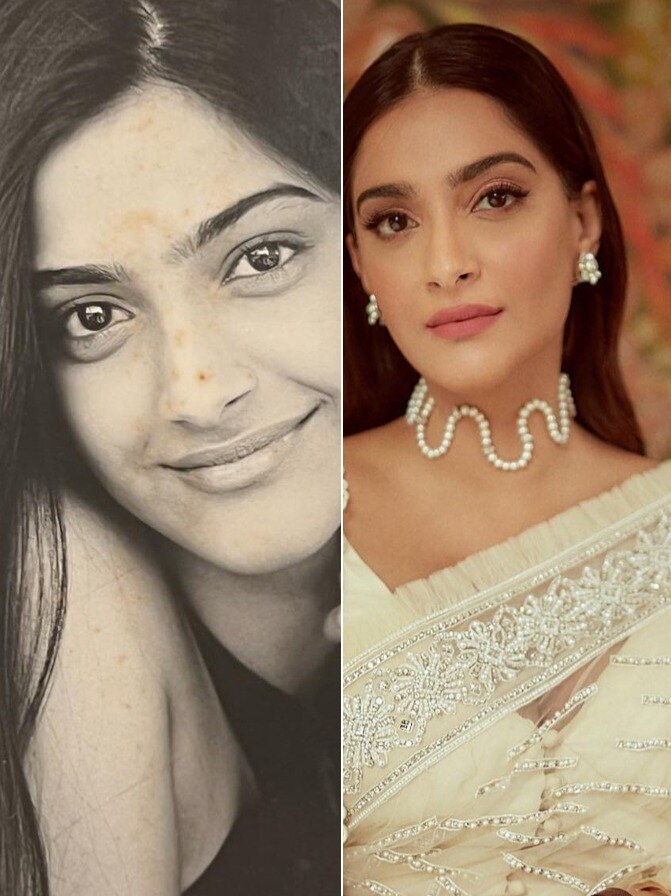 20 साल पहले ऐसी दिखती थीं सोनम कपूर, खुद को कैसे किया मेनटेन
