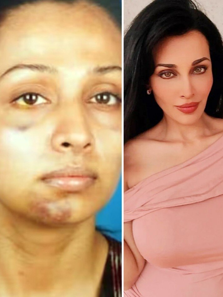 'मुंह पर मारा घूंसा', एक्ट्रेस को पार्टनर ने किया सेक्सुअल अब्यूज, रिलेशनश‍िप में झेला दर्द