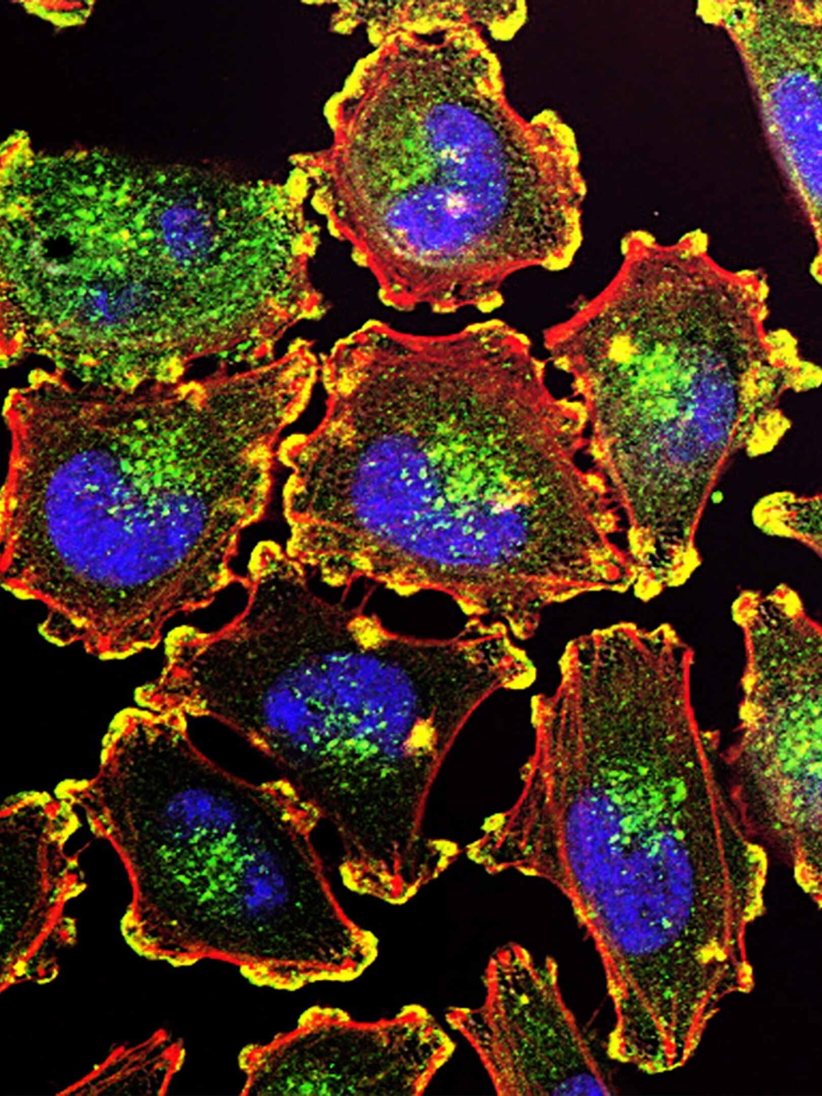 ক্যান্সারকে রুখে দেয় এই সবজি