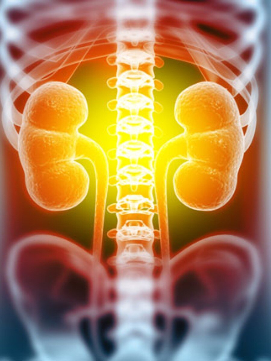 Nutrients That Can Damage Kidney sus