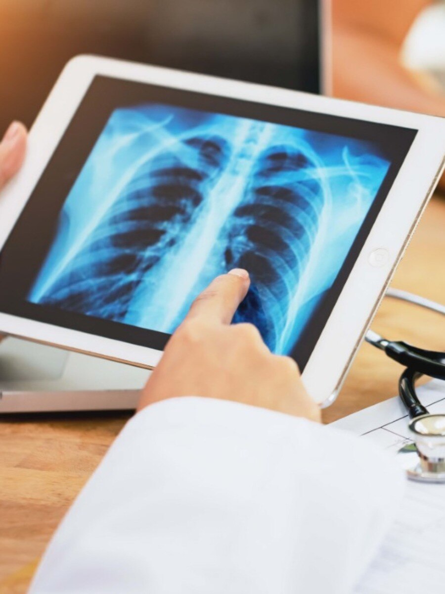 সিগারেট খেয়েও এভাবে সুস্থ রাখুন ফুসফুস