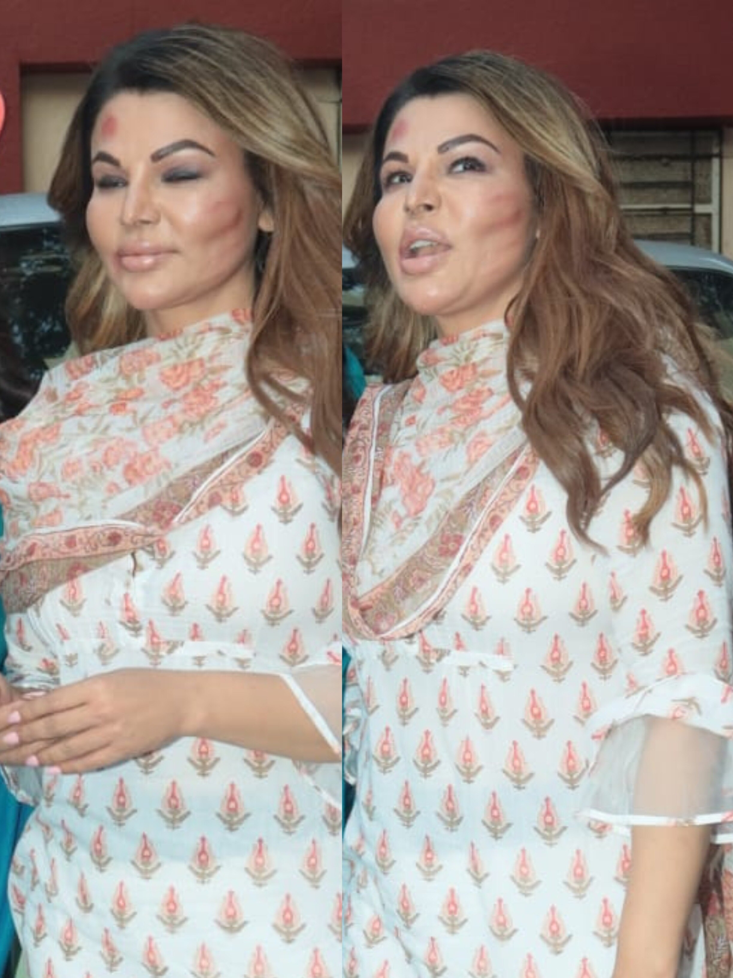 राखी के चेहरे पर चोट के निशान, यूजर्स ने पूछा- किसन पीटा? आदिल तो जेल में है