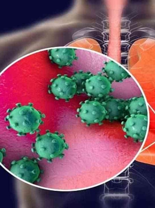 H3N2 influenza cases on the rise: All you need to know about symptoms, precautions