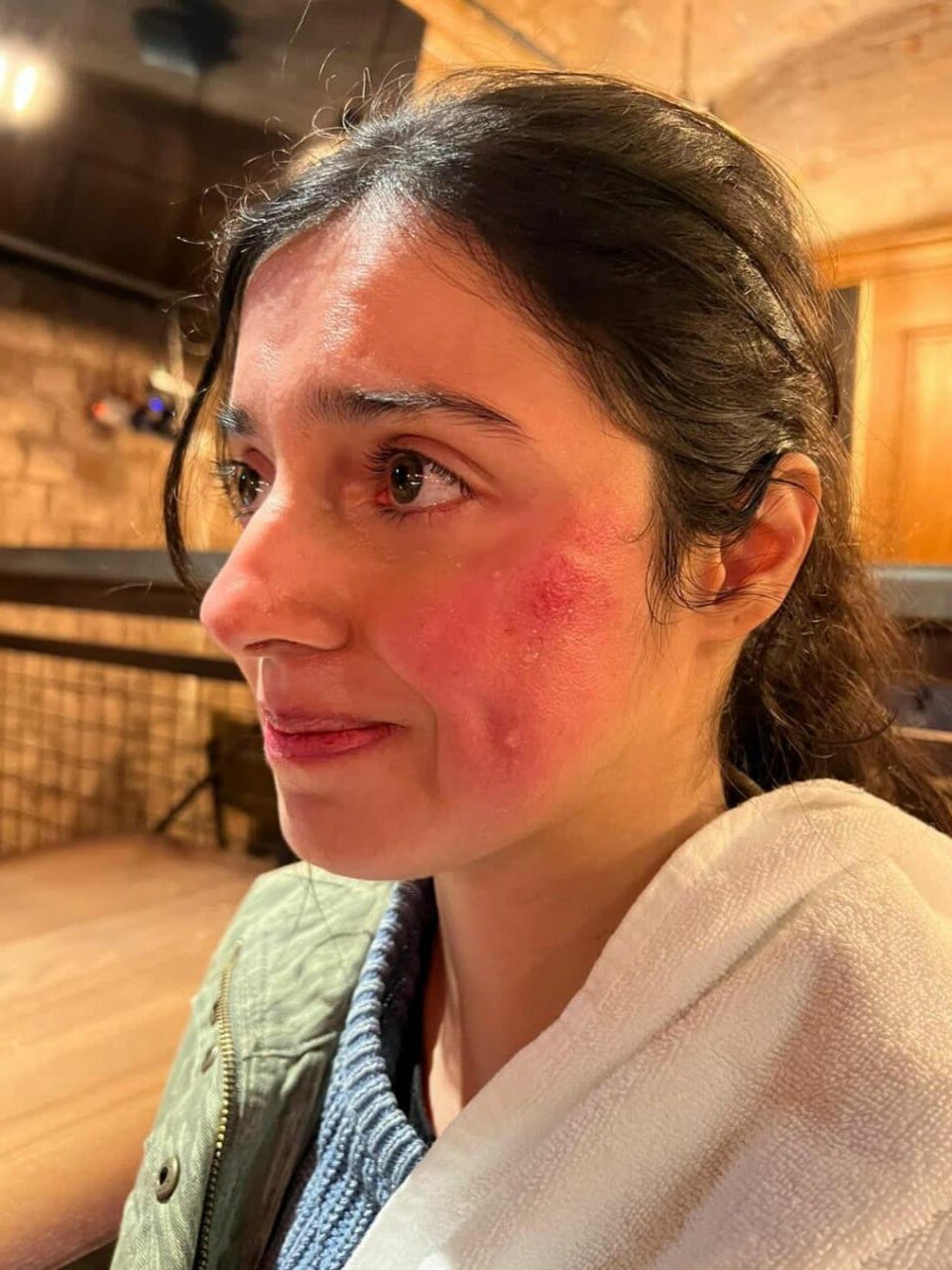 चेहरे पर जख्म, आंखों में आंसू, शूट‍िंग में हुआ कुछ ऐसा, बिगड़ा एक्ट्रेस का चेहरा