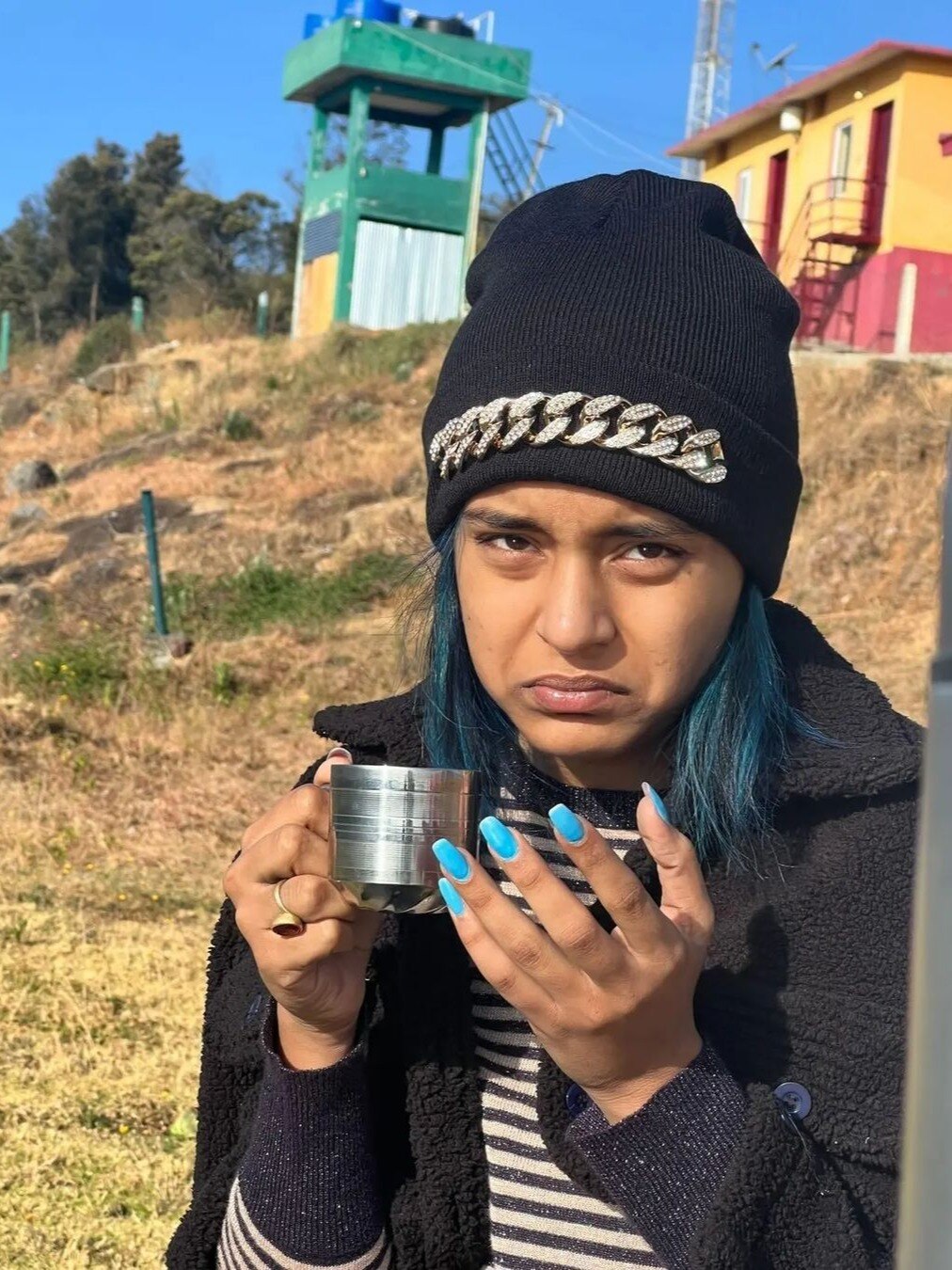 घूमने निकलीं इमली फेम सुम्बुल, बंदर ने किया परेशान, हाथ में आई चोट