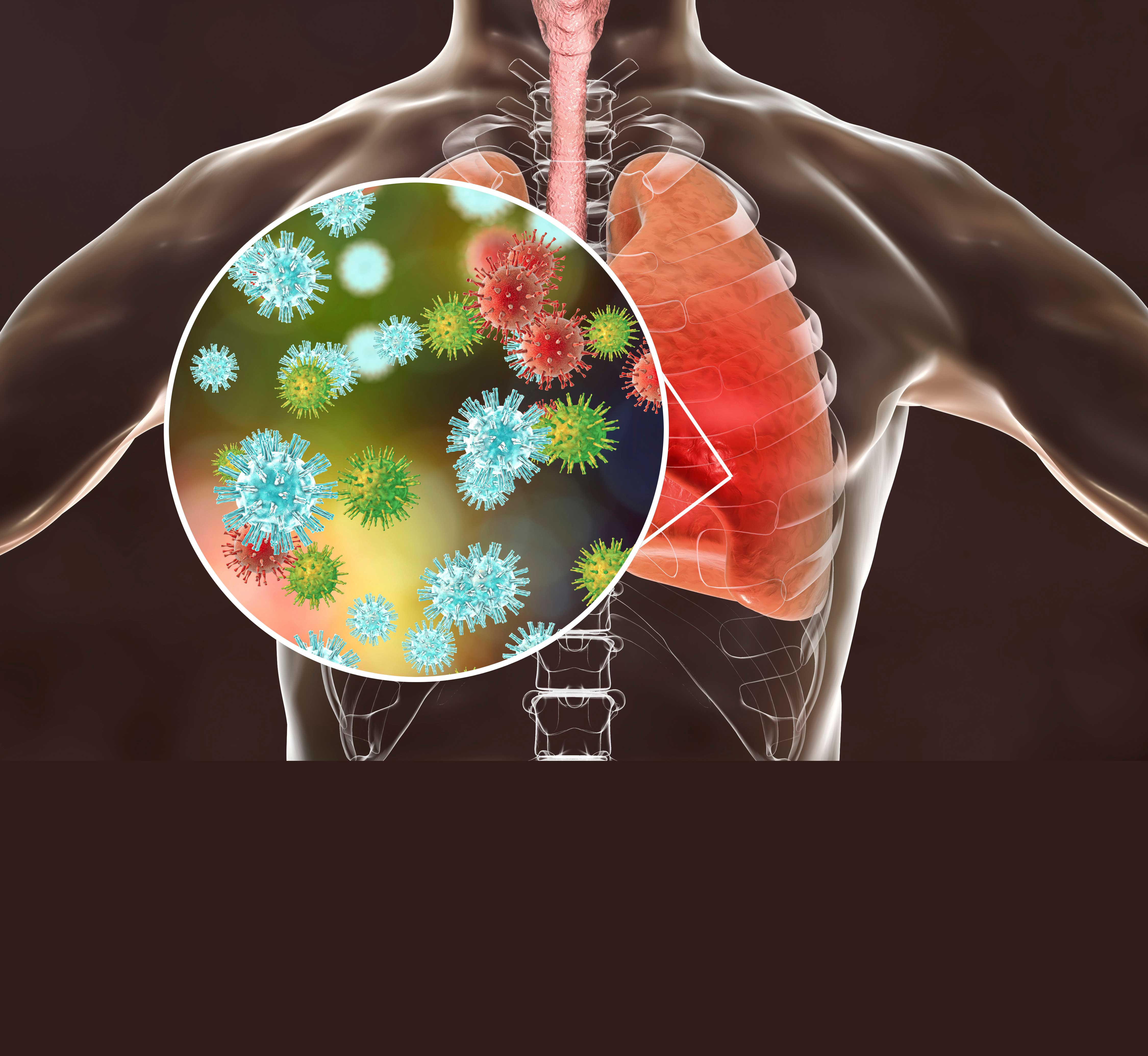 what is h3n2, why h3n2 cases are rising delhi