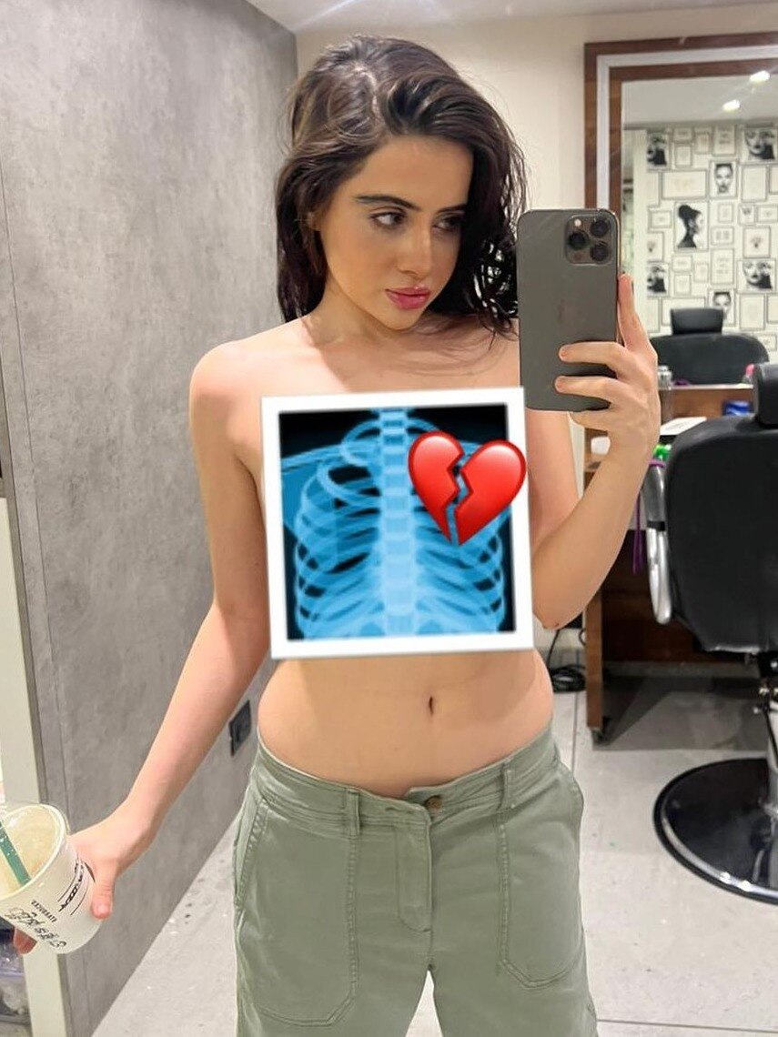 उर्फी को क्या हुआ? पहुंचीं डॉक्टर के पास, टॉपलेस होकर शेयर किया टूटे दिल का X-ray