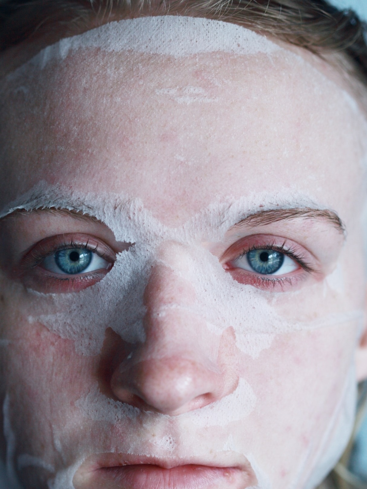 Home Remedies To Treat Old Scars