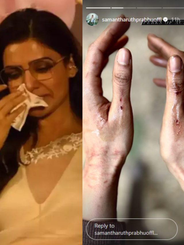 'सिटाडेल' के सेट पर सामंथा हुईं जख्मी, हाथों की चोट देख फैन्स का पसीजा दिल