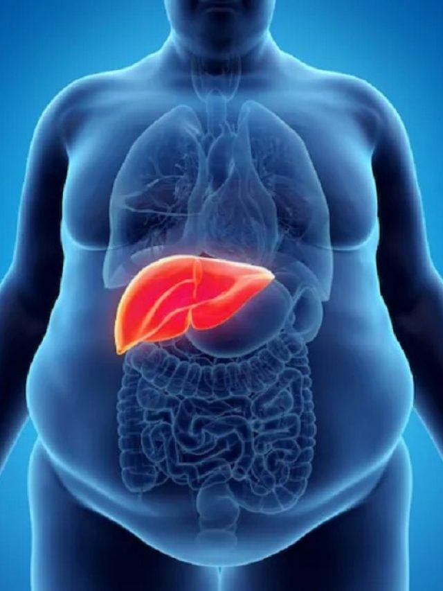 ফ্যাটি লিভারের কারণে হতে পারে মৃত্যুও, এই এক পানীয় দেবে পরিত্রাণ