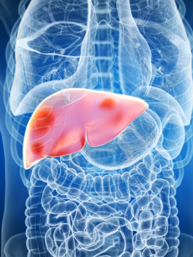 ইউরিক অ্যাসিডের কারণে  গাঁটে গাঁটে ব্যথা? এই ২ জুসে সমাধান