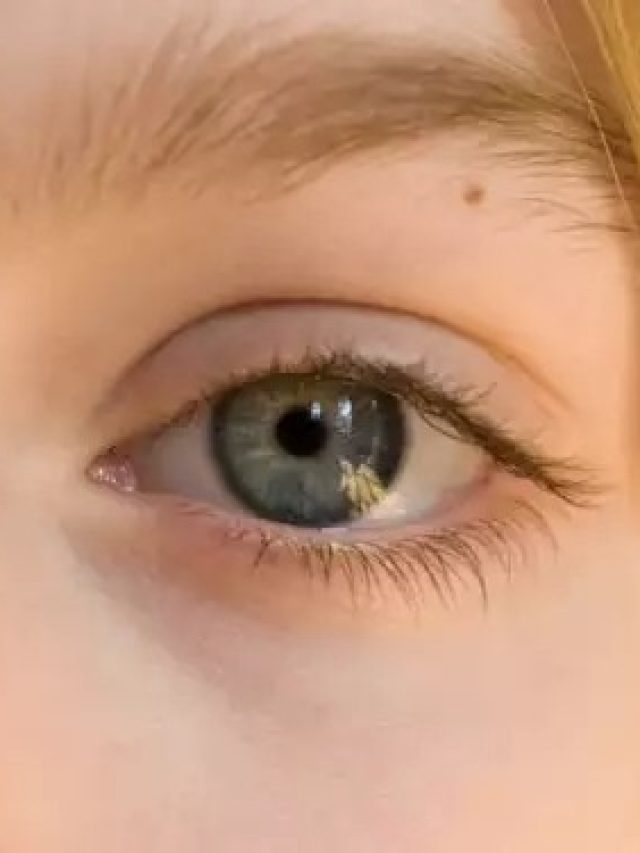 চোখ কাঁপা মানেই অশুভ? যা বলছে সামুদ্রিক শাস্ত্র