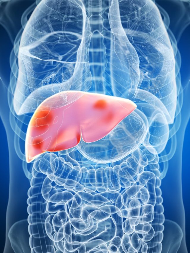 মদ্যপানে লিভারের বারোটা বাজে, সুরা প্রেমীরা ক্ষতি এড়াতে খান এই ৫ জিনিস