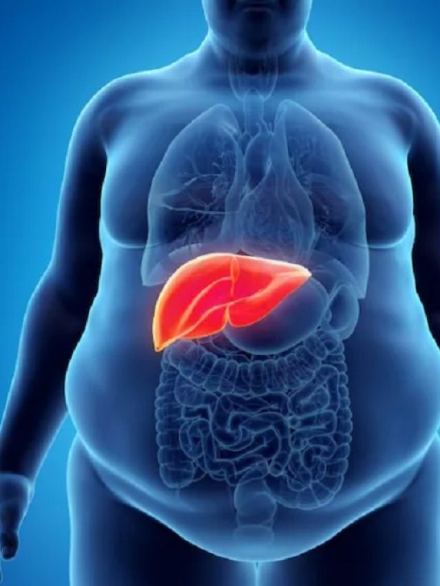 গরমেই লিভার বাড়ে, জেনে নিন উপসর্গ