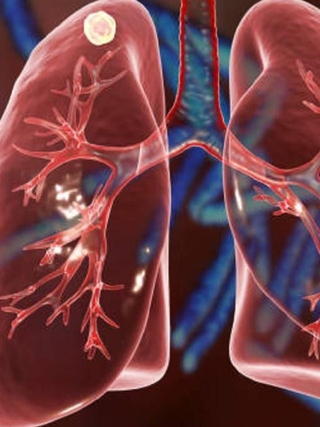 খাওয়ার পরই পেটে ব্যথা, গলব্লাডারে পাথর নেই তো?