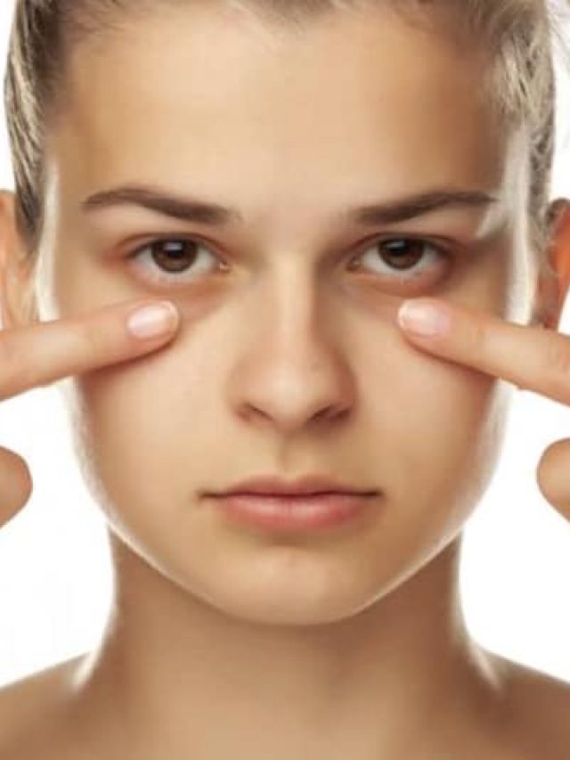 চোখে মুখে কালো দাগ-ছোপ? এসব ঘরোয়া উপায়ে দূর করুন