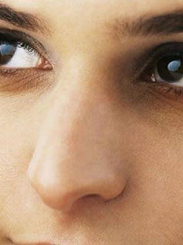 চোখের তলায় কালি? রইল দূর করার উপায়