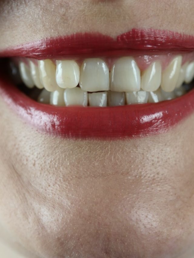 দাঁত হলুদ, সাদা হচ্ছেই না? ভিলেন যে খাবারগুলি