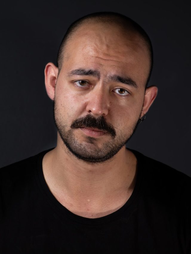 বিয়ের আগেই টাক? ৫ খাবারে দেদার চুল ওঠে