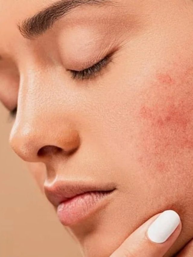 হঠাত্‍ ওজন কমছে, B12 ঘাটতি নয় তো? বাঁচার উপায়