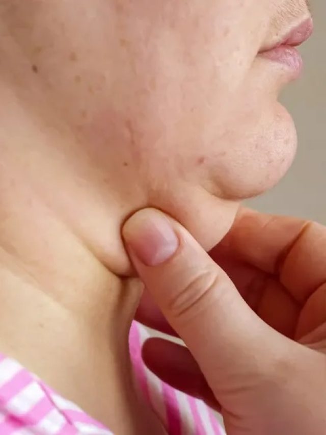 ডবল চিন নিয়ে নাজেহাল, কীভাবে কমাবেন?