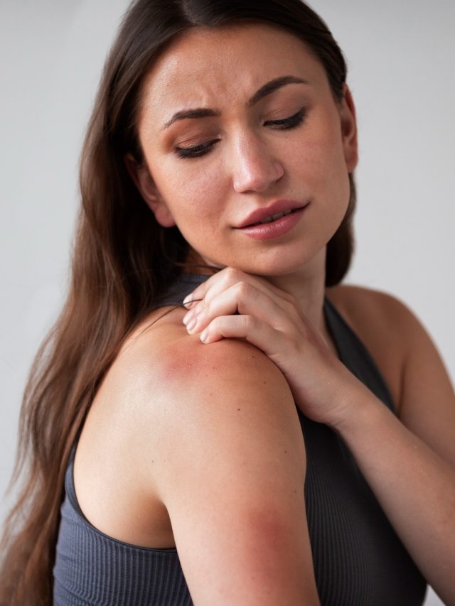 ঘামাচি থেকে মুক্তি মিলবে চট করে, রইল ৭ ঘরোয়া উপায়