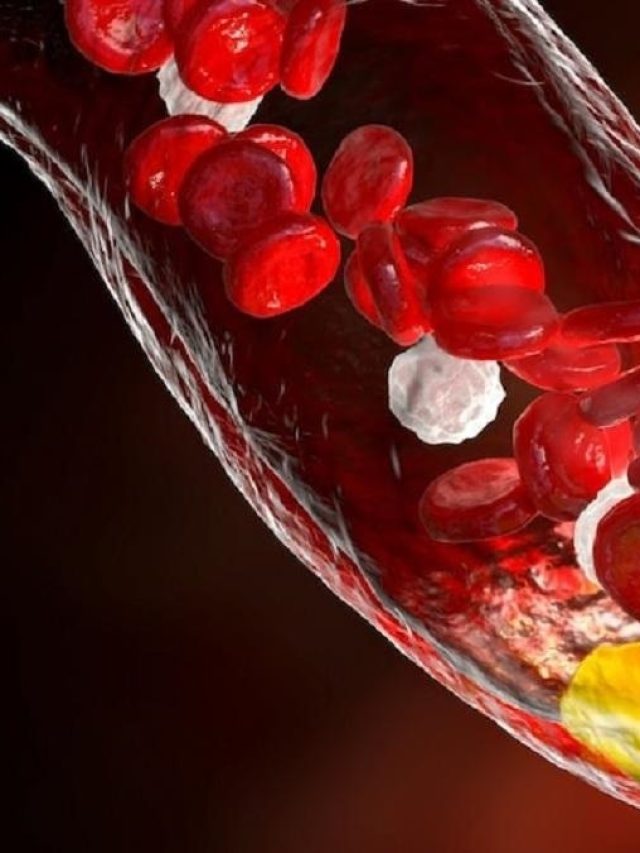 কোলেস্টেরল বাড়ছে, এই ৫ লক্ষণে জানিয়ে দেয় পা