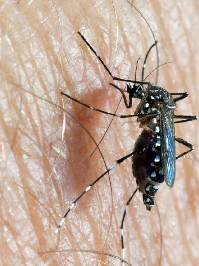 মশা কামড়ালে চুলকোয় কেন?