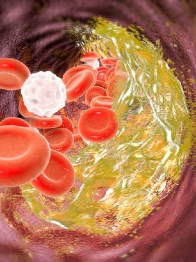 तेजी से कम होने लगेगा कोलेस्ट्रॉल लेवल, रोज सुबह पिएं ये चीज