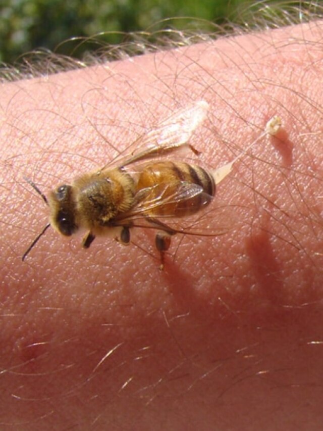 মৌমাছির হুল! ৬ ঘরোয়া টোটকায় যন্ত্রণামুক্তি