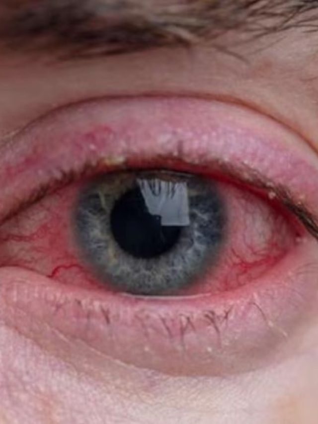 সব সময় চোখ ভার লাগে? হতে পারে এই রোগের প্রথম লক্ষণ