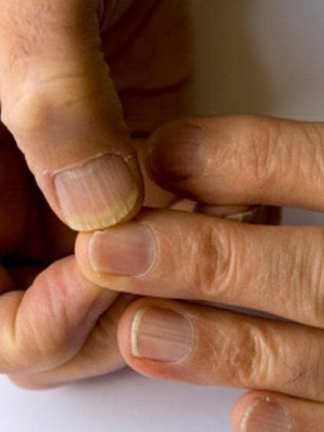 যৌন ক্ষমতা থেকে অর্থাভাব, বলে দেবে আপনার নখ