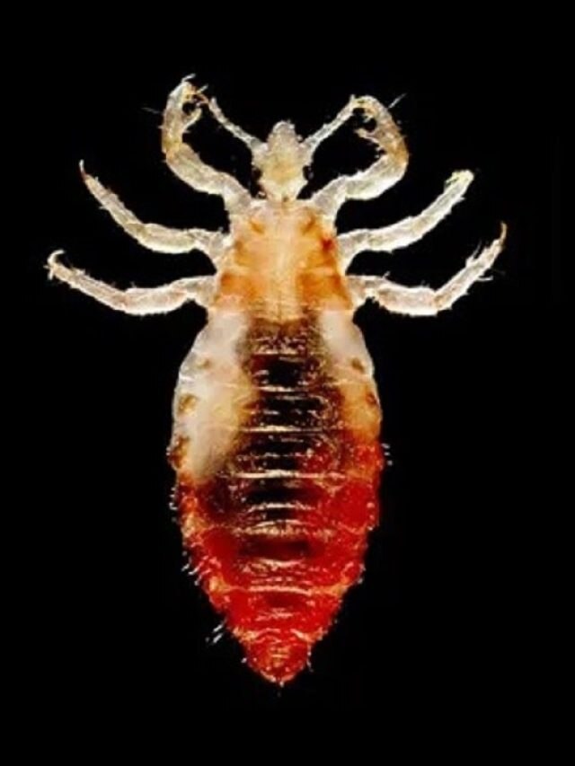 মাথায় উকুনের বাসা? কিলবিলে উকুনের বংশ নাশ  হবে! তাড়ানোর সহজ টোটকা