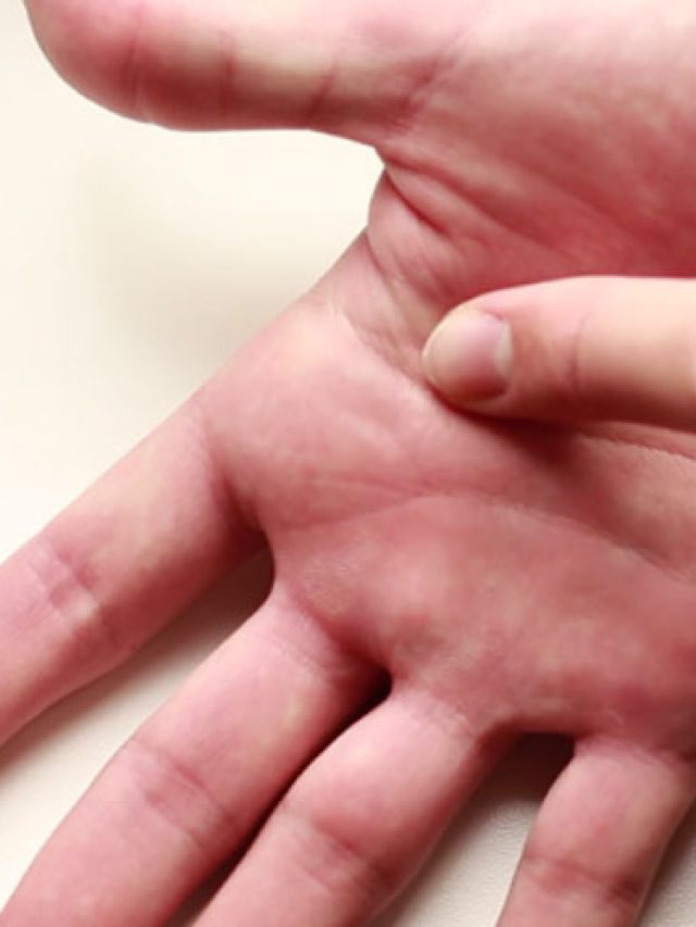 আঙ্গুলের গঠন এমন হলে স্ত্রীয়েরা হন পতিব্রতা, লক্ষ্মীমন্ত; মিলিয়ে নিন