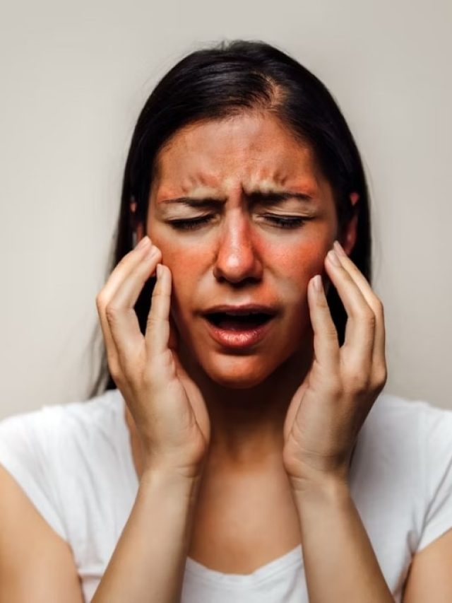 শরীরে অ্যাসিড পড়লে কী করবেন? জানুন  প্রাথমিক চিকিৎসা