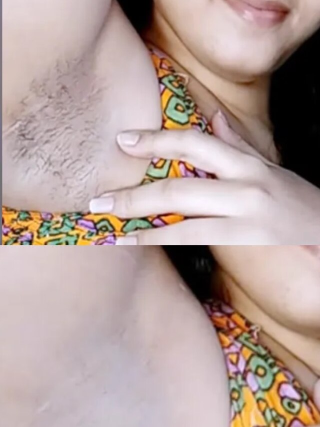 বগলের লোম‌ ও কালো দাগছোপ তোলার ৫ ঘরোয়া উপায়