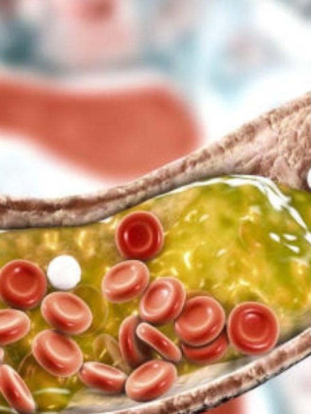 ডায়েটে এই ৫ খাবার রাখলেই জব্দ কোলেস্টেরল